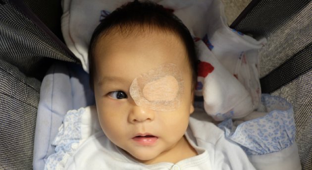 Cirugía de catarata en niños y adultos en Querétaro