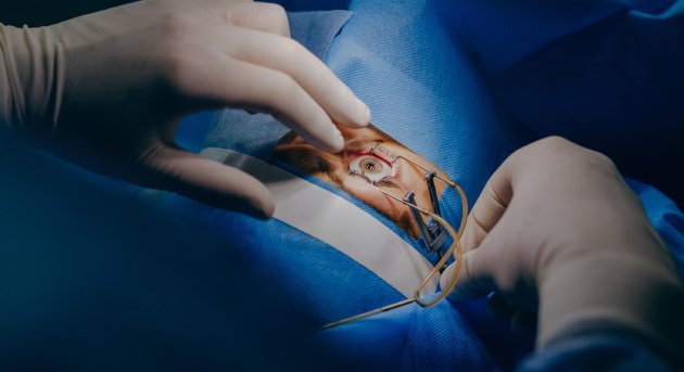 Cirugía de pterigión en Querétaro: Especialidad en Oftalmología Pediátrica