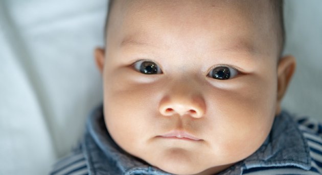 Tratamiento de dacrioestenosis congénita en Querétaro